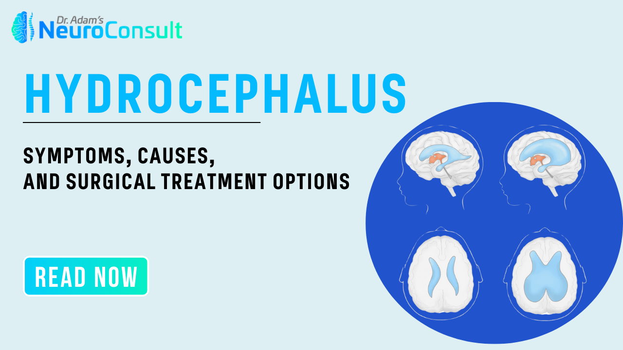 hydrocephalus