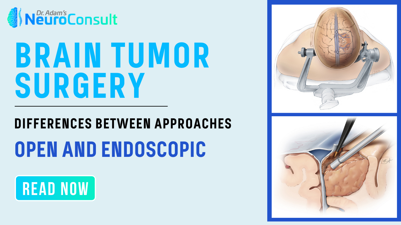 Minimal Invasive Brain Surgery