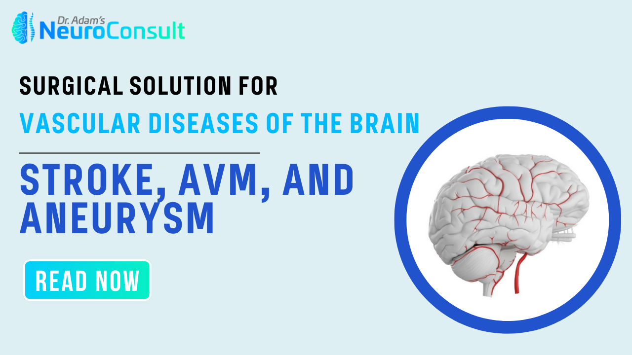 Stroke, AVM, and Aneurysm