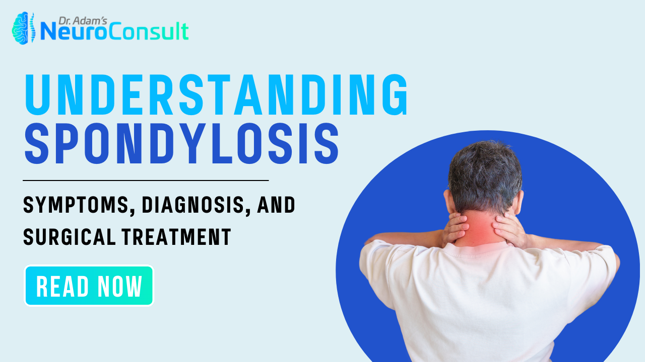 Spondylosis