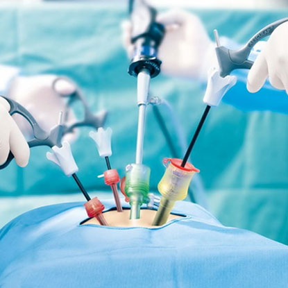 minimal-invasive-surgery